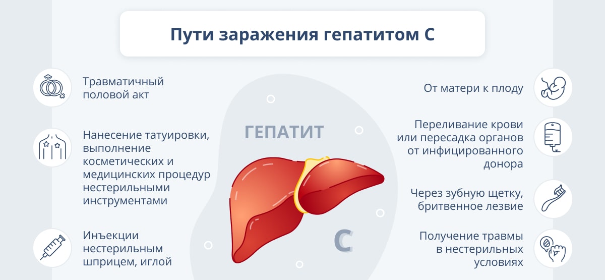 Хронический гепатит с презентация